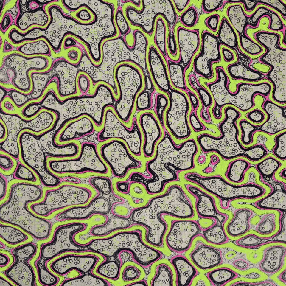 Resonance, seed 405348